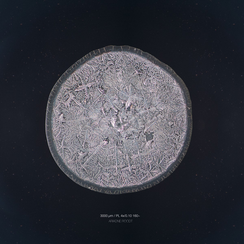 Illustration for article titled The Beautiful Secrets of Tears, Revealed By a Microscope